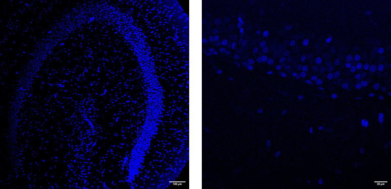 Slice DAPI x10 + DAPI x40