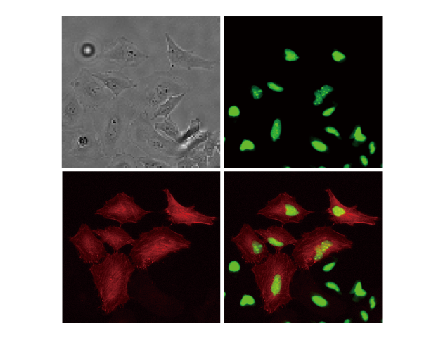 Multicolor fluorescence and brightfield imaging