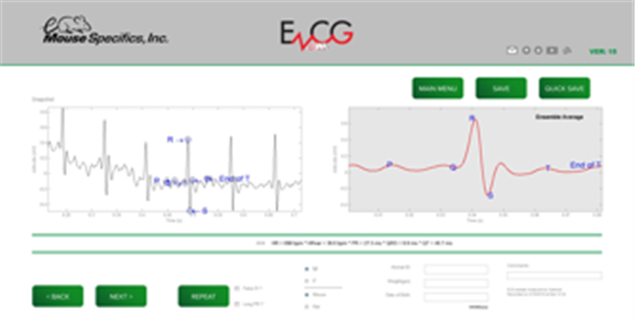 Heart Monitoring ECGenie